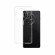 PanzerGlass CARE by PanzerGlass X-Ray Case OnePlus Nord CE 5