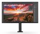 LG 32UN880K-B #2