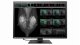 Eizo RadiForce RX1270 #2
